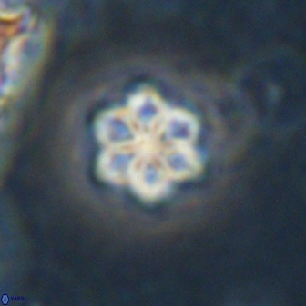 Olladiscoaster lepidus 30610