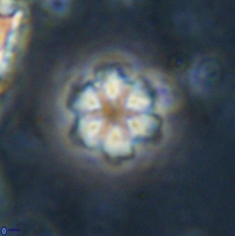 Olladiscoaster lepidus 30611