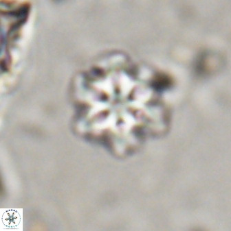 Olladiscoaster lepidus 30613