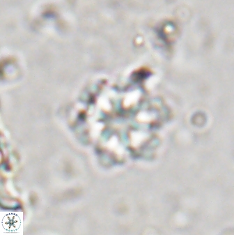 Olladiscoaster lepidus 30625
