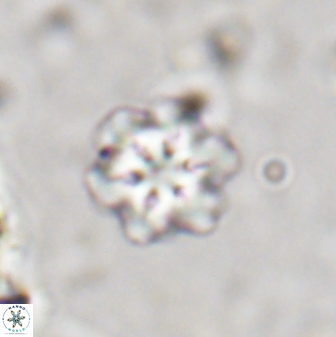 Olladiscoaster lepidus 30626