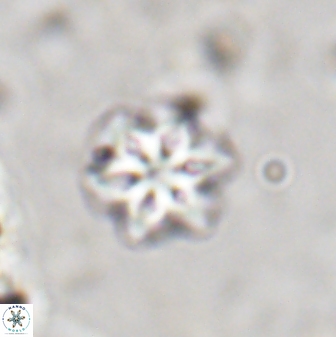 Olladiscoaster lepidus 30627