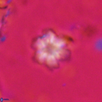 Olladiscoaster lepidus 30623