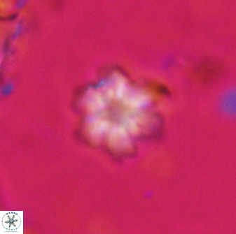 Olladiscoaster lepidus 30623