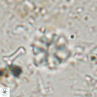 Olladiscoaster lepidus 30807