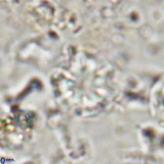 Olladiscoaster lepidus 30808