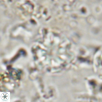 Olladiscoaster lepidus 30808