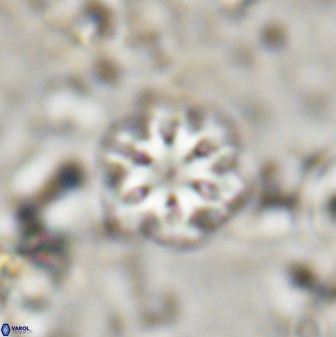 Olladiscoaster lepidus 30809