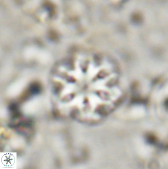 Olladiscoaster lepidus 30809