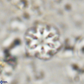 Olladiscoaster lepidus 30814