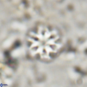 Olladiscoaster lepidus 30815