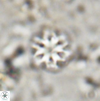 Olladiscoaster lepidus 30815