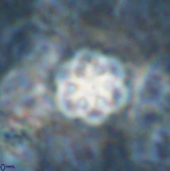 Olladiscoaster lepidus 30816