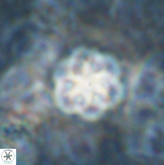 Olladiscoaster lepidus 30816