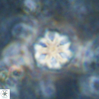 Olladiscoaster lepidus 30817