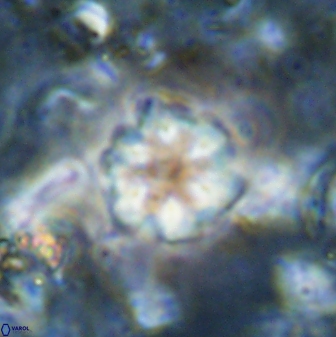 Olladiscoaster lepidus 30818