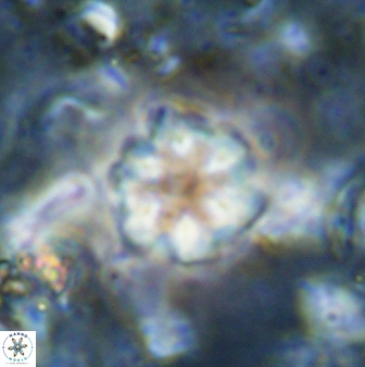 Olladiscoaster lepidus 30818