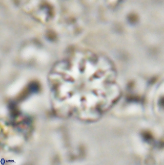 Olladiscoaster lepidus 30811