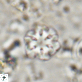 Olladiscoaster lepidus 30811