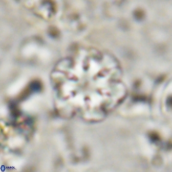 Olladiscoaster lepidus 30812