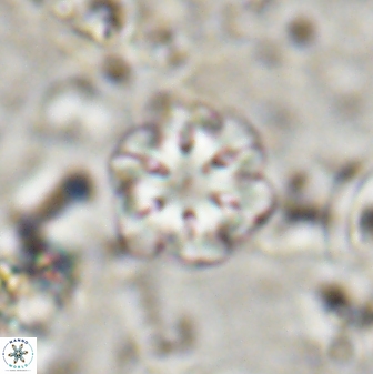Olladiscoaster lepidus 30812