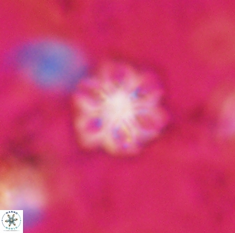Olladiscoaster lepidus 30824