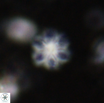 Olladiscoaster lepidus 30825