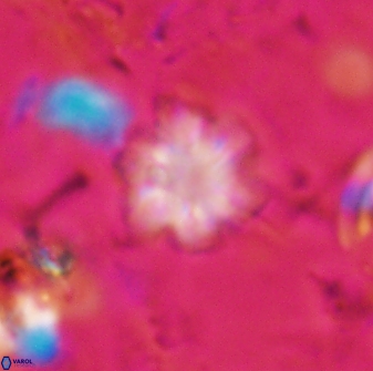 Olladiscoaster lepidus 30828