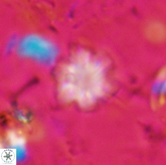 Olladiscoaster lepidus 30828