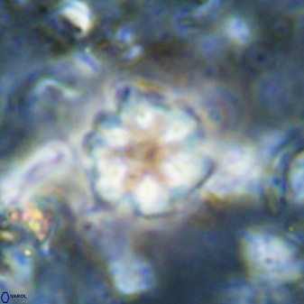 Olladiscoaster lepidus 30820