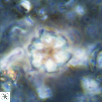 Olladiscoaster lepidus 30820