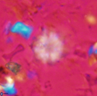 Olladiscoaster lepidus 30830