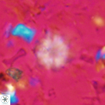Olladiscoaster lepidus 30830