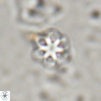 Olladiscoaster lepidus 30969