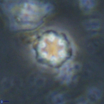 Olladiscoaster lepidus 30974