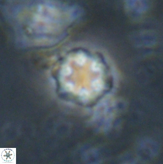 Olladiscoaster lepidus 30974
