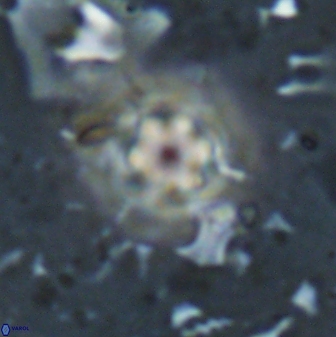 Olladiscoaster lepidus 30975