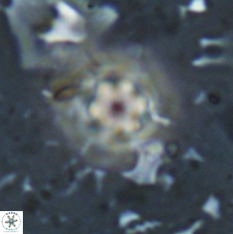 Olladiscoaster lepidus 30975