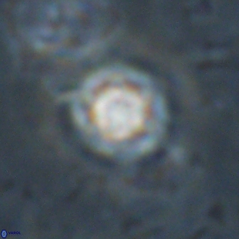 Olladiscoaster lepidus 30971