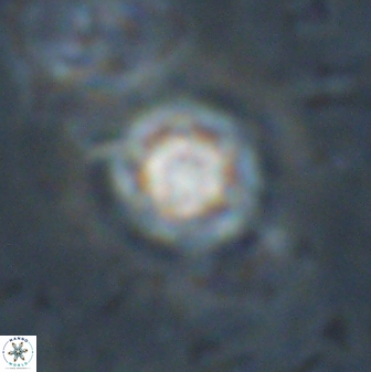 Olladiscoaster lepidus 30971