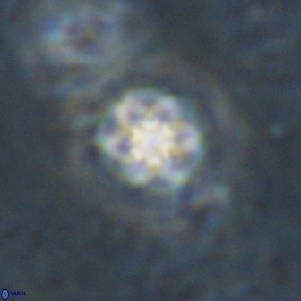 Olladiscoaster lepidus 30972