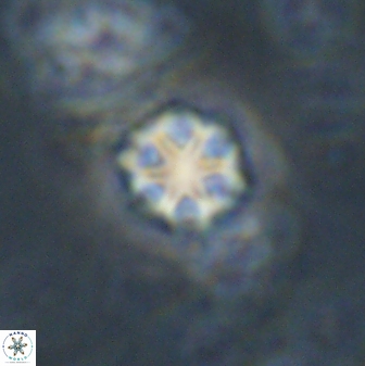Olladiscoaster lepidus 30973
