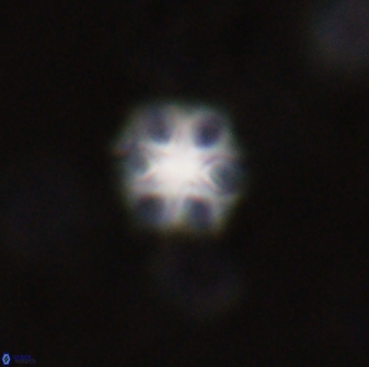 Olladiscoaster lepidus 30984