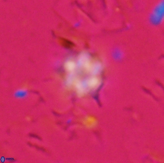 Olladiscoaster lepidus 30985