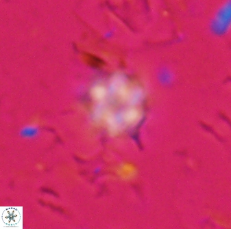Olladiscoaster lepidus 30985