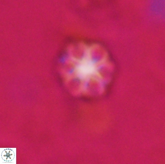 Olladiscoaster lepidus 30983