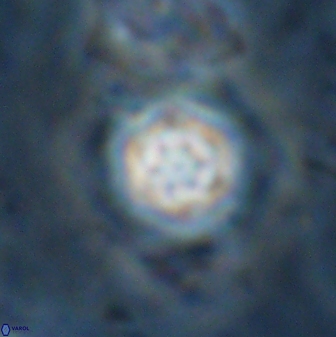 Olladiscoaster lepidus 30994