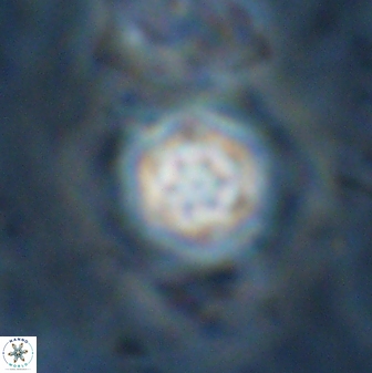 Olladiscoaster lepidus 30994