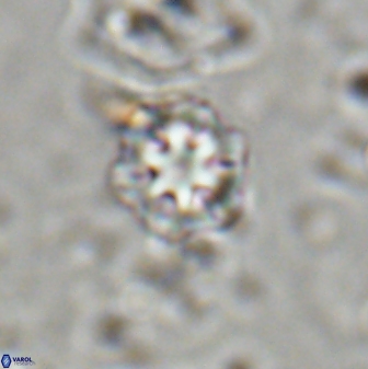 Olladiscoaster lepidus 30999