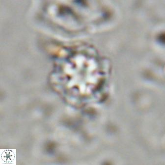 Olladiscoaster lepidus 30999